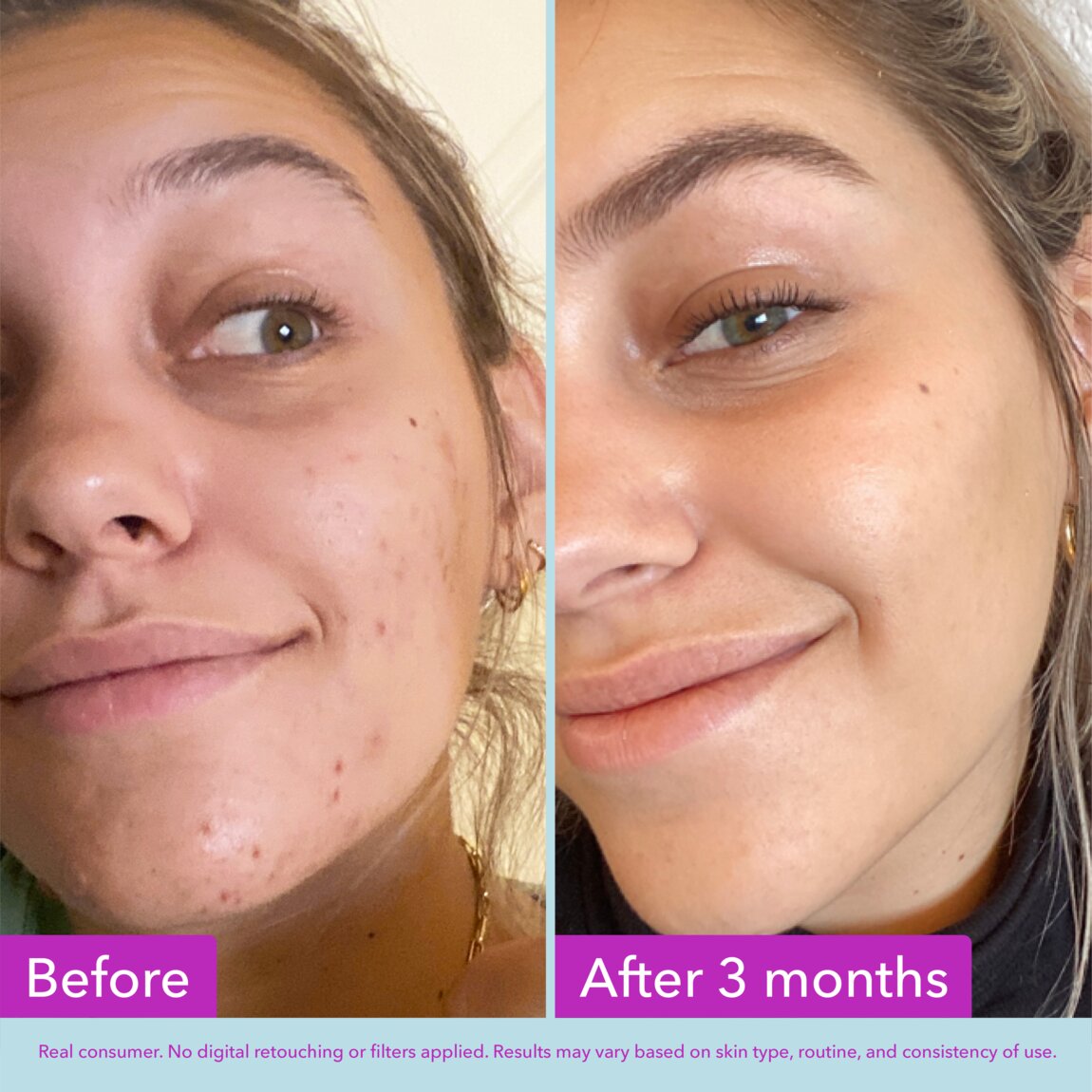 niacinamide-brightening-toner-t6 zb_p.jpg