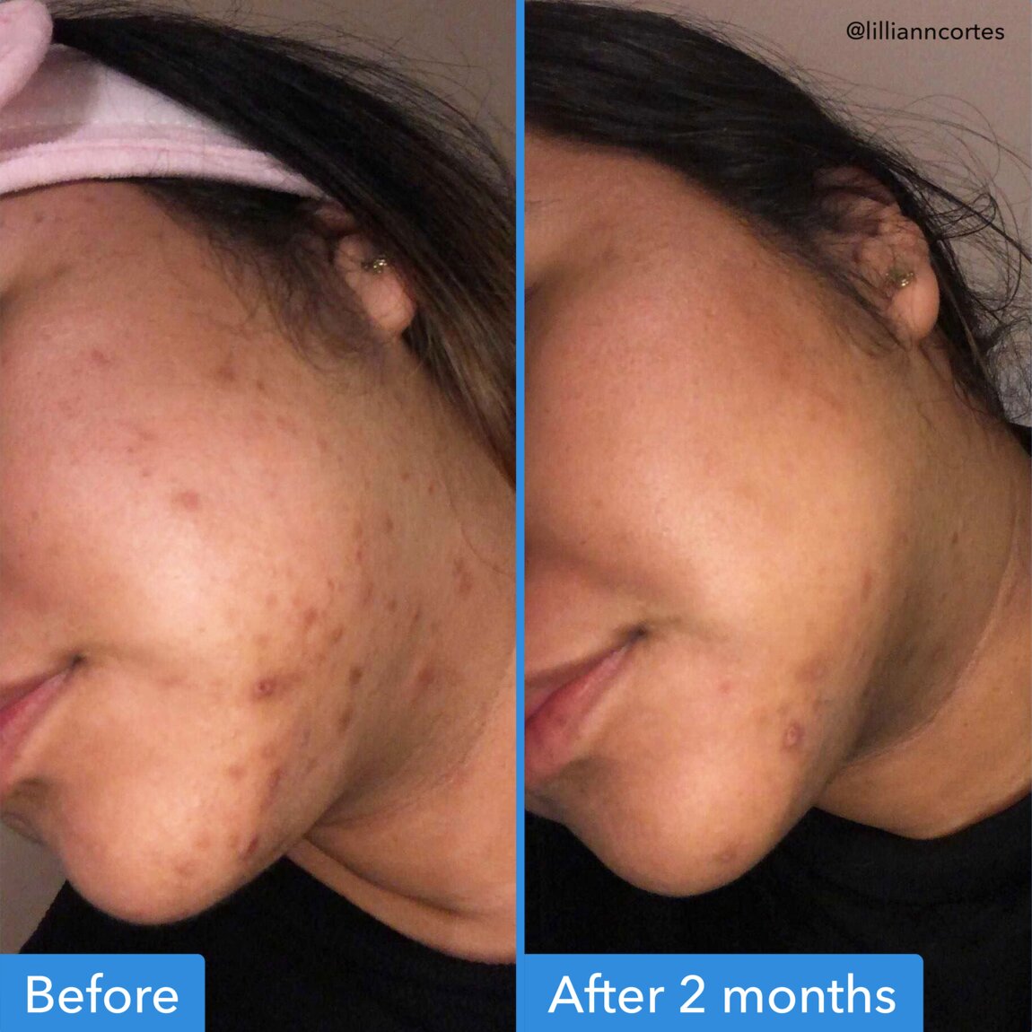 discoloration-correcting-serum-b0 zb_p.jpg