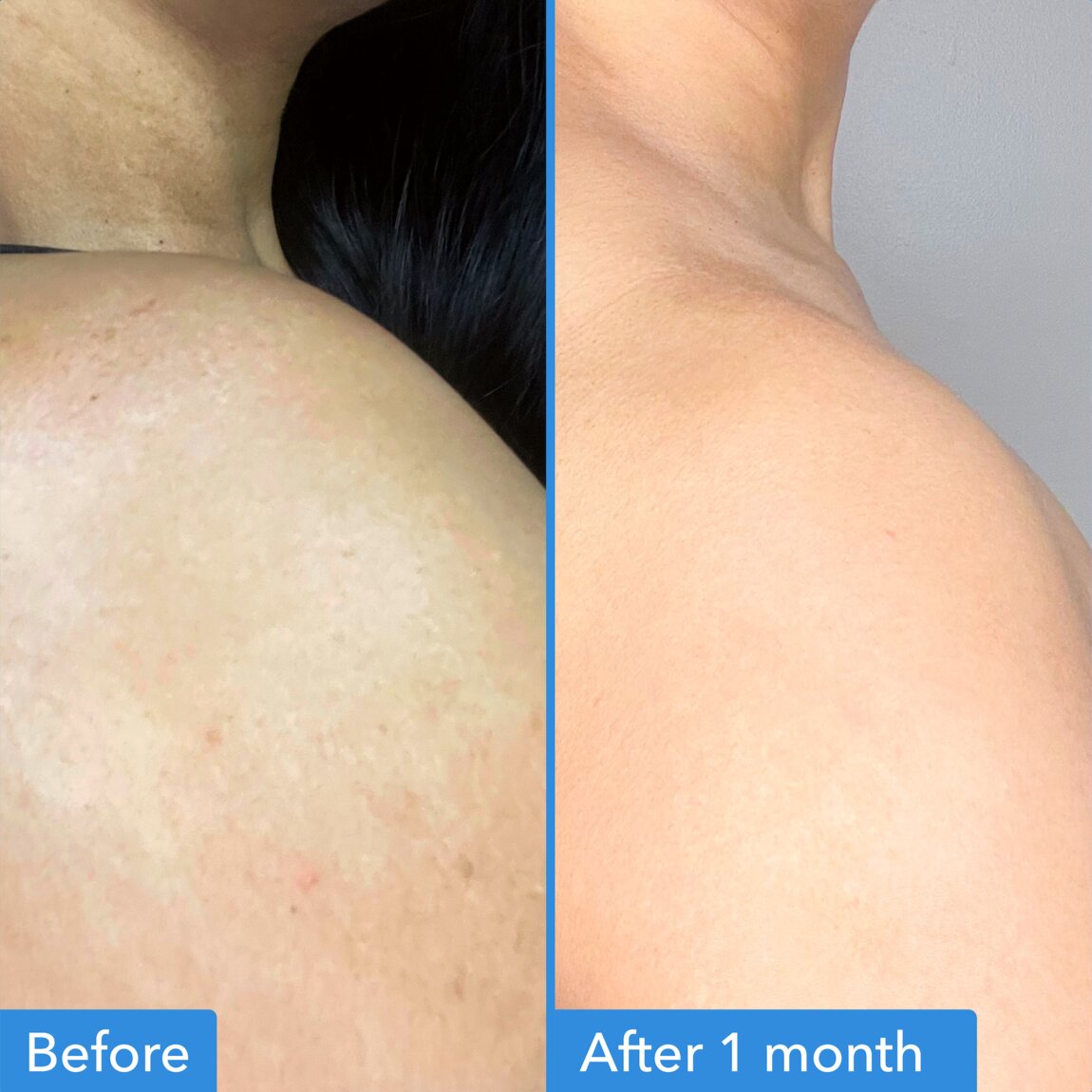 discoloration-correcting-body-treatment-w4 zb_p.jpg